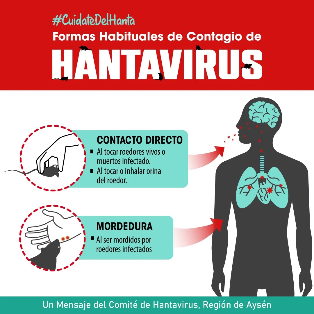 Formas Habituales de Contagio de Hantavirus